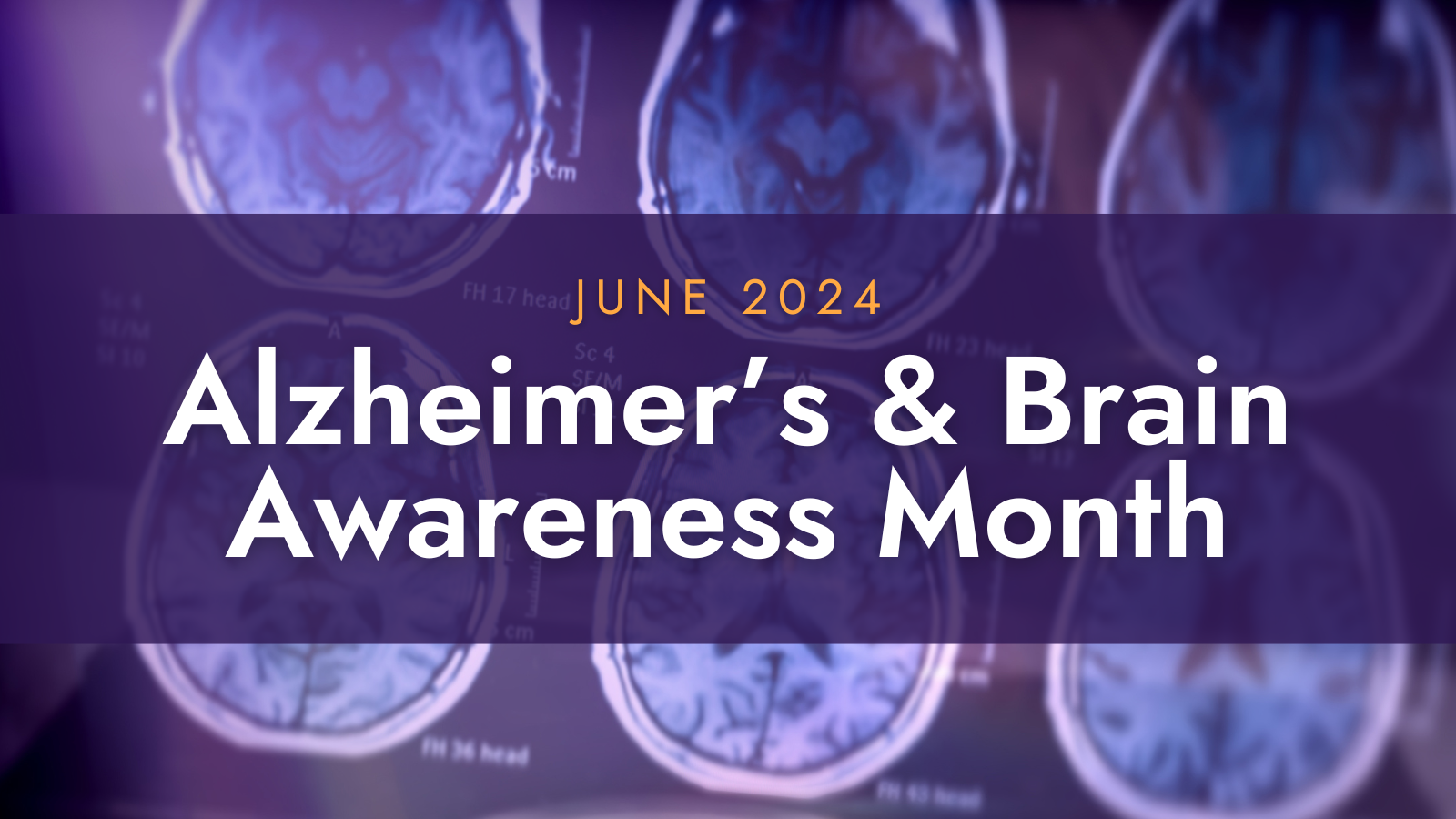 June is Alzheimer’s & Brain Health Awareness Month Precision Aging